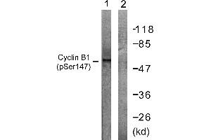 Immunohistochemistry analysis of paraffin-embedded human placenta tissue using Cyclin B1 (Phospho-Ser147) antibody.