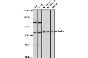 Western blot analysis of extracts of various cell lines, using CT antibody (ABIN6129529, ABIN6139174, ABIN6139175 and ABIN6217150) at 1:3000 dilution. (CTAGE1 抗体  (AA 370-520))