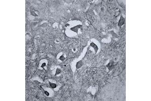IHC on mouse brain (cryo section) using Rabbit antibody to RhoA  at a concentration of 15 µg/ml, incubated overnight and developed with DAB Ni. (RHOA 抗体  (AA 100-150))