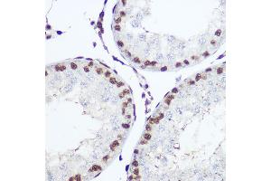 Immunohistochemistry (IHC) image for anti-Nuclear Factor I/A (NFIA) (AA 180-330) antibody (ABIN1681040)