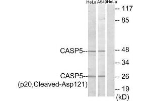 Western blot analysis of extracts from HeLa cells and A549 cells, treated with etoposide (25uM, 24hours), using CASP5 (p20, Cleaved-Asp121) antibody. (CASP5 抗体  (Cleaved-Asp121, Internal Region))