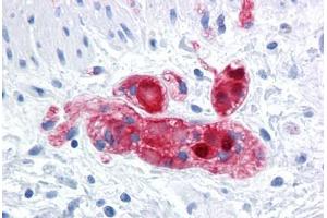 Immunohistochemistry (Formalin-fixed Paraffin-embedded Sections) (IHC (fp)) image for anti-Secretagogin, EF-Hand Calcium Binding Protein (SCGN) (AA 1-277) antibody (ABIN574421)