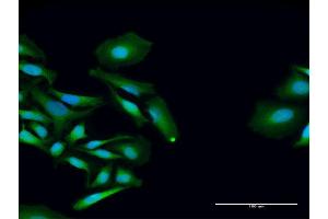 Immunofluorescence of purified MaxPab antibody to PCID2 on HeLa cell. (PCID2 抗体  (AA 1-397))