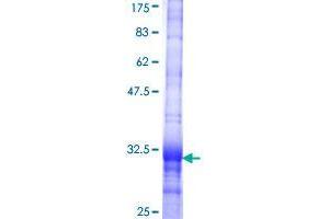 SLC25A18 Protein (AA 124-184) (GST tag)