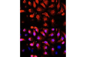 Immunofluorescence analysis of HeLa cells using  antibody (ABIN1678557, ABIN3017993, ABIN3017994, ABIN5664400 and ABIN6220331) at dilution of 1:100 (40x lens). (ACTN2 抗体  (AA 1-250))