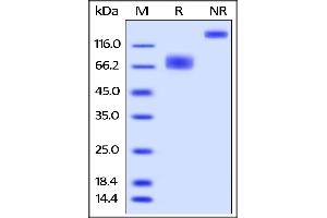 SDS-PAGE (SDS) image for Natural Killer Cell Receptor 2B4 (CD244) (AA 22-221) (Active) protein (Fc Tag,AVI tag,Biotin) (ABIN5526627)