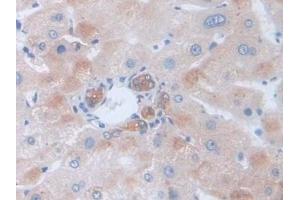 Detection of GLa in Human Liver Tissue using Polyclonal Antibody to Galactosidase Alpha (GLa) (GLA 抗体  (AA 81-429))