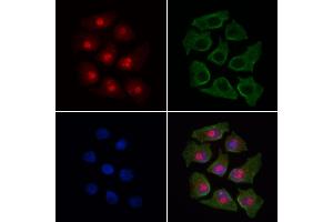 ABIN6263615 and ABIN6269188 staining HepG2 cells by IF/ICC.