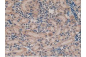 IHC-P analysis of Rat Kidney Tissue, with DAB staining. (SFTPB 抗体  (AA 111-329))