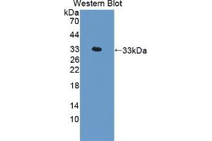 Detection of Recombinant IL22R, Rat using Polyclonal Antibody to Interleukin 22 Receptor (IL22R) (IL22R 抗体  (AA 242-485))