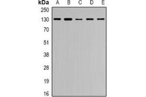 Western blot analysis of Collagen 4 alpha 1 expression in Hela (A), MCF7 (B), U2OS (C), HEK293T (D), VEC (E) whole cell lysates. (COL4A1 抗体)