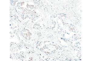 Immunohistochemistry (IHC) image for anti-Mismatch Repair Protein 2 (MSH2) (AA 625-675) antibody (ABIN7453978) (Recombinant MSH2 抗体  (AA 625-675))
