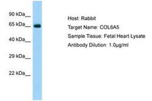 Image no. 1 for anti-Collagen, Type VI, alpha 5 (COL6A5) (AA 2427-2476) antibody (ABIN6750094) (Collagen, Type VI, alpha 5 (COL6A5) (AA 2427-2476) 抗体)