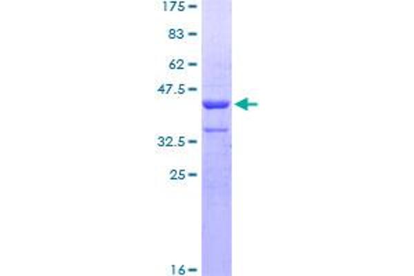 ZNHIT3 Protein (AA 1-155) (GST tag)