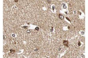 ABIN6276654 at 1/100 staining human brain tissue sections by IHC-P.