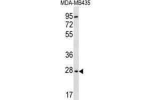 Western Blotting (WB) image for anti-2,3-bisphosphoglycerate Mutase (BPGM) antibody (ABIN2996852) (BPGM 抗体)