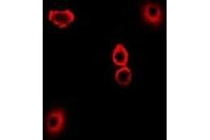 Immunofluorescent analysis of TXNL1 staining in U2OS cells. (TXNL1 抗体)