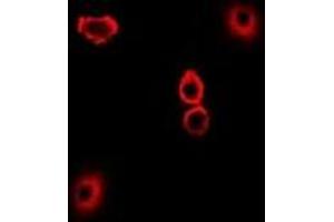 Immunofluorescent analysis of TXNL1 staining in U2OS cells.