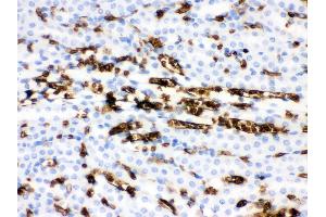 Immunohistochemistry (IHC) image for anti-Solute Carrier Family 4, Anion Exchanger, Member 1 (erythrocyte Membrane Protein Band 3, Diego Blood Group) (SLC4A1) (AA 28-365) antibody (ABIN3043930)