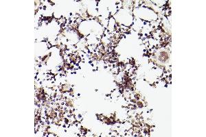 Immunohistochemistry of paraffin-embedded rat bone marrow using TET2 antibody (ABIN1513598, ABIN3022074, ABIN3022075 and ABIN6218597) at dilution of 1:100 (40x lens). (TET2 抗体  (AA 1833-2002))