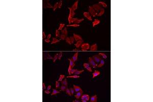 Immunofluorescence analysis of MCF7 cells using SK antibody . (SKAP2 抗体  (AA 1-120))