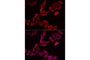 Immunofluorescence analysis of MCF7 cells using SK antibody . (SKAP2 抗体  (AA 1-120))