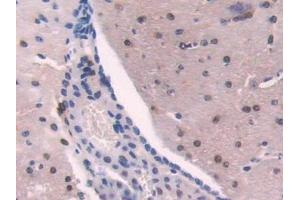 Detection of ADK in Mouse Cerebrum Tissue using Polyclonal Antibody to Adenosine Kinase (ADK) (ADK 抗体  (AA 1-361))
