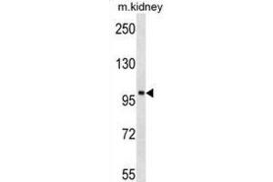 Western Blotting (WB) image for anti-tyrosine Kinase, Non-Receptor, 2 (TNK2) antibody (ABIN3003439) (TNK2 抗体)