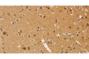 Immunohistochemistry of paraffin-embedded Human brain using PSMC1 Polyclonal Antibody at dilution of 1:40 (PSMC1 抗体)