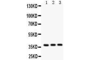 Anti- IL3 antibody, Western blotting All lanes: Anti IL3  at 0. (IL-3 抗体  (AA 28-166))
