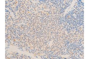 Immunohistochemistry (IHC) image for anti-Mitogen-Activated Protein Kinase Kinase Kinase 7 (MAP3K7) (pThr187) antibody (ABIN6256492)