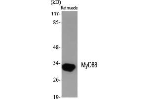 Western Blot analysis of various cells using MyD88 Polyclonal Antibody diluted at 1:2000. (MYD88 抗体  (Internal Region))