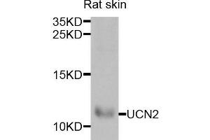 Western blot analysis of extracts of rat skin, using UCN2 antibody (ABIN5973879) at 1/1000 dilution. (Urocortin 2 抗体)