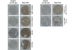 Immunohistochemistry Mab-C48 or control IgG (1 g /mL) was applied to human normal organ tissue array and tumor tissue array. (BST2 抗体)