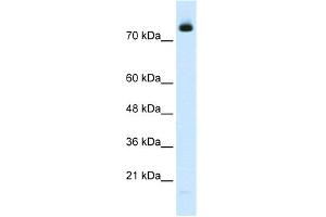 WB Suggested Anti-ZMYM3 Antibody Titration:  2. (ZMYM3 抗体  (N-Term))