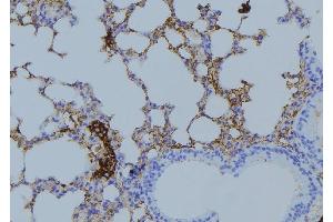 ABIN6275023 at 1/100 staining Mouse lung tissue by IHC-P. (COPZ1 抗体  (N-Term))