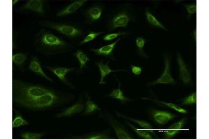 Immunofluorescence of monoclonal antibody to RPN1 on HeLa cell. (RPN1 抗体  (AA 24-607))