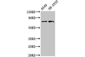 Western Blot Positive WB detected in: A549 whole cell lysate, SH-SY5Y whole cell lysate All lanes: MASP2 antibody at 2. (MASP2 抗体  (AA 189-314))
