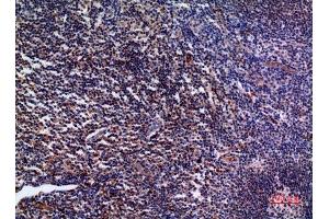 Immunohistochemistry (IHC) image for anti-Interleukin 28 (IL28) (C-Term) antibody (ABIN3181017)