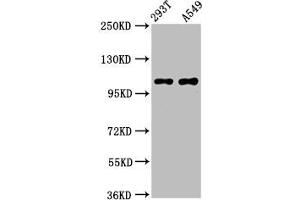 Western Blot Positive WB detected in: 293T whole cell lysate, A549 whole cell lysate All lanes: ICE2 antibody at 4. (NARG2 抗体  (AA 876-982))