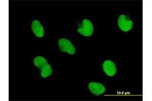 Immunofluorescence of purified MaxPab antibody to ZNF165 on HepG2 cell. (ZNF165 抗体  (AA 1-485))