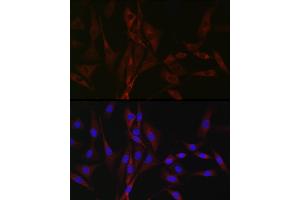 Immunofluorescence (IF) image for anti-Calcium Channel, Voltage-Dependent, T Type, alpha 1H Subunit (CACNA1H) (AA 260-360) antibody (ABIN7266015)
