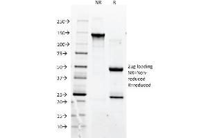 SDS-PAGE Analysis Purified CD90 Mouse Monoclonal antibody (F15-42-1). (CD90 抗体)