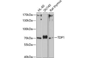 Western blot analysis of extracts of various cell lines, using TDP1 Antibody (ABIN1682992, ABIN3019238, ABIN3019239 and ABIN6220782) at 1:1000 dilution. (TDP1 抗体  (AA 1-140))