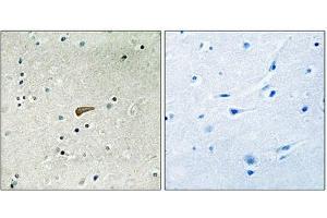Immunohistochemical analysis of paraffin-embedded human brain tissue using FRS2 (Phospho-Tyr436) antibody (left)or the same antibody preincubated with blocking peptide (right). (FRS2 抗体  (pTyr436))