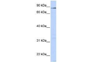WB Suggested Anti-L3MBTL4 Antibody Titration:  0. (L3MBTL4 抗体  (N-Term))