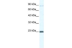 WB Suggested Anti-MCM4 Antibody Titration:  5. (MCM4 抗体  (C-Term))