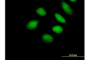 Immunofluorescence of purified MaxPab antibody to SUHW1 on HeLa cell. (ZNF280A 抗体  (AA 1-542))