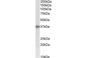 AP32139PU-N Delta-Sarcoglycan antibody staining of Human Heart lysate at 0. (SGCD 抗体  (Internal Region))