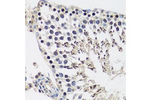 Immunohistochemistry of paraffin-embedded rat testis using C antibody (ABIN6127552, ABIN6137952, ABIN6137953 and ABIN6216977) at dilution of 1:100 (40x lens). (CASC5 抗体  (AA 1-300))
